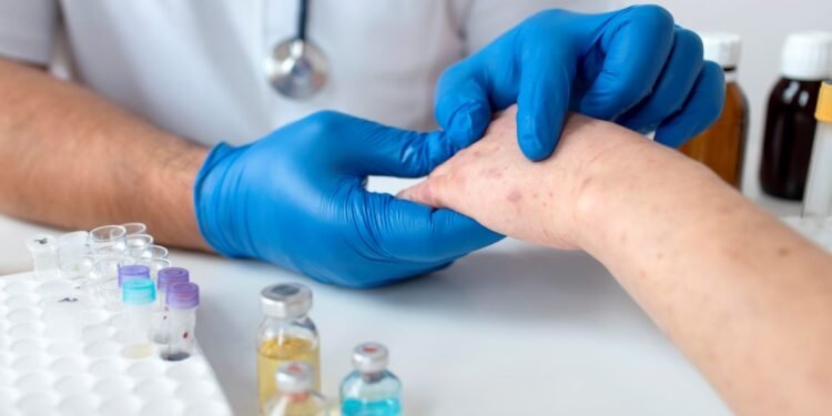 Salud pública en alerta: las 32 entidades del país confirman casos de sarampión