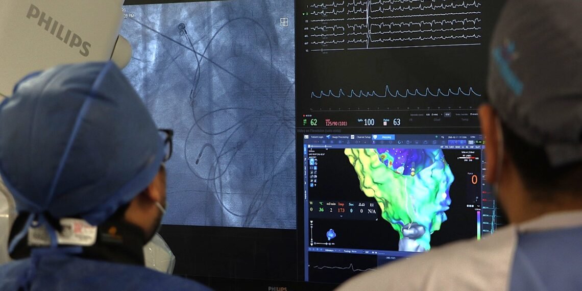 Yucatán revoluciona tratamiento de las arritmias con tecnología 3D sin radiación