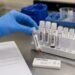 ¿Puede llegar el hantavirus a México? Expertos responden tras la alerta sanitaria internacional