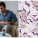 ¡Cuidado con lo que comes! Ola de calor convierte comidas en focos de infección