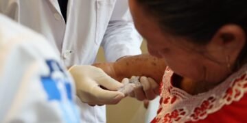 IMSS Bienestar lleva rehabilitación física a personas sin seguridad social