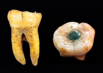 Los mayas ya practicaban tratamientos dentales hace más de mil años; esto revela un estudio