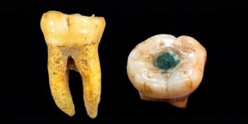 Los mayas ya practicaban tratamientos dentales hace más de mil años; esto revela un estudio