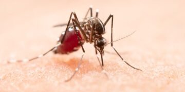 Detectan malaria en turista que viajó a Guadalajara por el Mundial: ¿hay riesgo?