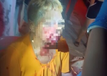 Pitbulls salen de un predio y atacan a una abuelita en calles de la Bojórquez