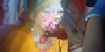 Pitbulls salen de un predio y atacan a una abuelita en calles de la Bojórquez