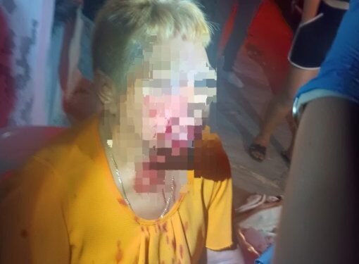 Pitbulls salen de un predio y atacan a una abuelita en calles de la Bojórquez